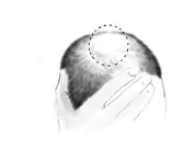 Un diagnostic plus efficace